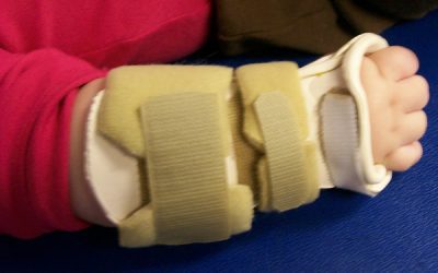 Pediatric Hand Therapy and Orthotic Intervention for Musculoskeletal Conditions
