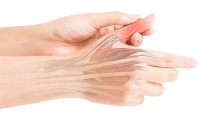 Treating Tendonitis in the Upper Extremity